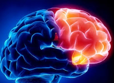 Epilepsia: conheça os sintomas